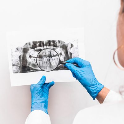 A woman doctor in protective medical gloves holds an X-ray picture of teeth in her hands and examines it through a magnifying glass on a white background A woman doctor in protective medical gloves holds an X-ray picture of teeth in her hands and examines it through a magnifying glass on a white background.